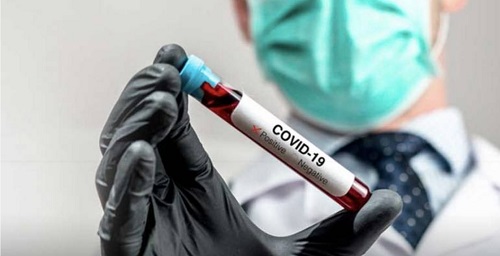 COVID wave in UAE: 244 fresh cases, 0 deaths, 441 recoveries